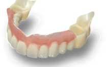 Съемный зубной протез «Сэндвич»